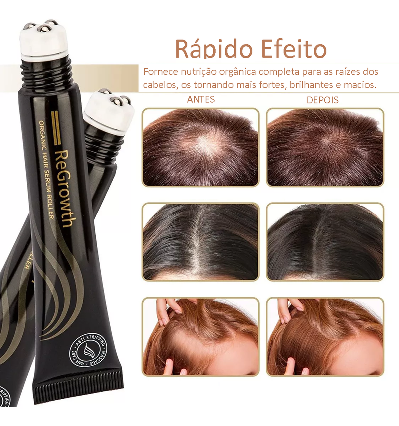 (Pague 1 Leve 2) Repair Hair® - Diminui a queda e aumenta o crescimento do cabelo - Frete Grátis